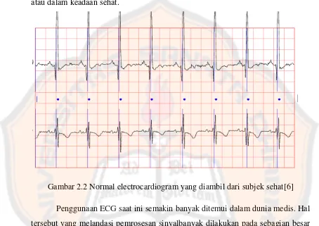 Gambar 2.2 Normal electrocardiogram yang diambil dari subjek sehat[6] 