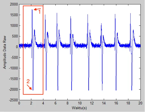 Gambar 2.7 Sinyal EOG yang terekam dalam sinyal EEG pada saat berkedip 