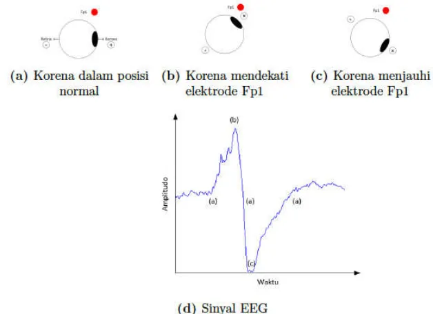 Gambar 2.8 Munculnya sinyal EOG akibat aktivitas kedipan mata 