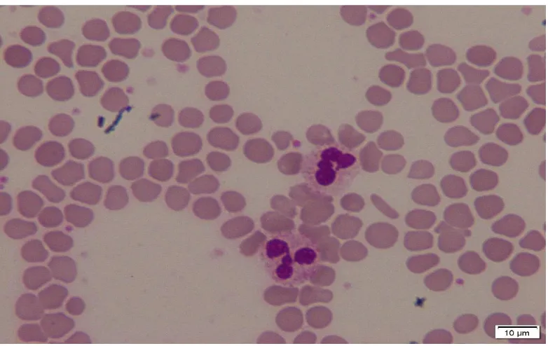 Gambar 3.13 citra sel darah merah menumpuk (overlapping). 