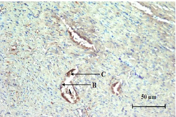 Gambar 2.  Gambaran  imunohistokimia  arteria  koronaria  tikus  putih  yang  diberi  pakan  lemak  tinggi  (P1)  selama 90 hari