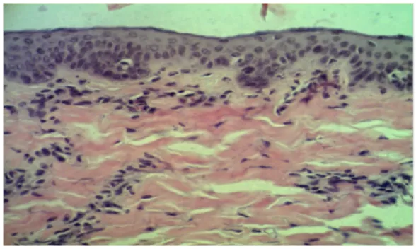 Gambar 1.  Mikroskopik potongan kulit babi  pada daerah luka yang dibuat 0 jam  postmortem  dan diambil 12 jam postmortem