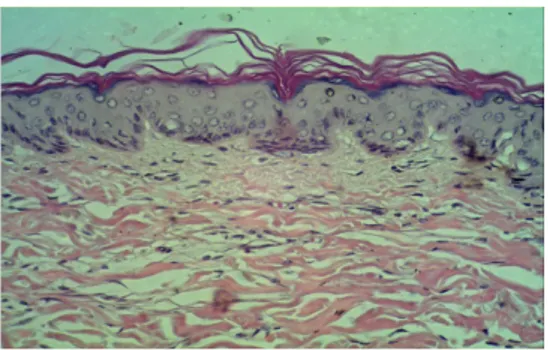 Gambar 2.  Mikroskopik potongan kulit babi  pada daerah luka yang dibuat 3 jam  postmortem  dan diambil 12 jam postmortem