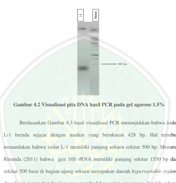 Gambar 4.2 Visualisasi pita DNA hasil PCR pada gel agarose 1.5% 