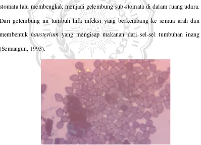 Gambar 2.2.3.a. Urediospora Phakopsora pachyrizi, penyebab penyakit  karat daun kedelai (10x)  (Sumber: Semangun, 1996) 