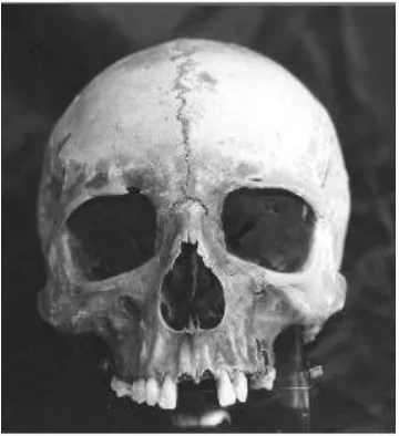 Gambar 2.1   Tulang tengkorak manusia (Abate et al. 2004). 