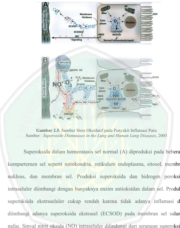 Gambar 2.5. Sumber Stres Oksidatif pada Penyakit Inflamasi Paru  Sumber : Superoxide Dismutases in the Lung and Human Lung Diseases, 2003 