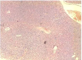 Gambar Histopatologi Organ Ginjal 
