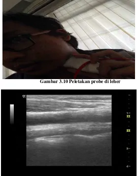 Gambar 3.11 Hasil cira ultrasoun