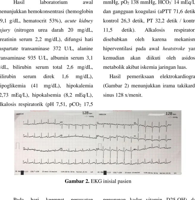 Gambar 2. EKG inisial pasien 