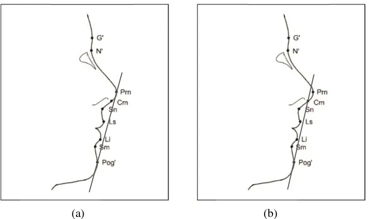 Gambar 13. Garis-garis Referensi yang Digunakan. a. Garis E (Pronasale-Pogonion Kulit), b