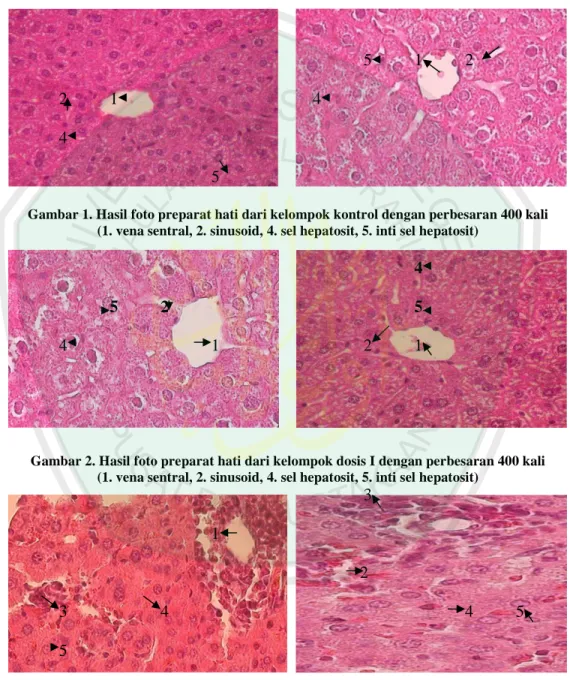 Gambar 1. Hasil foto preparat hati dari kelompok kontrol dengan perbesaran 400 kali  (1