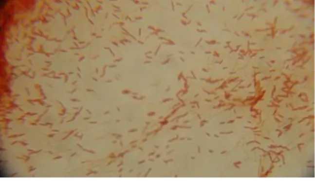 Gambar 10. Bacillus – Gram Positif  