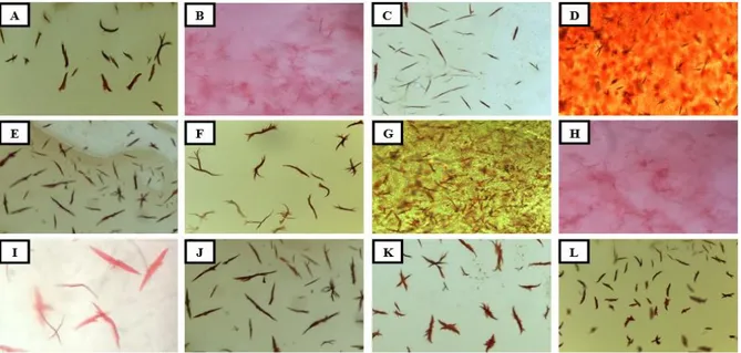 Gambar 3  Kristal hemoglobin pada preparat bercak darah dengan tes Takayama  setelah dipapar sabun A, B, C, D, E, F, G, H, I, J, K, L dengan perbesaran 40x10 