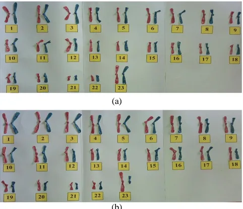 Gambar 1.7: (a) kariotipe manusia: nomor 1 hingga 22 merupakan autosomal  dan 23 adalah kromosom kelamin (XX), (b) kariotipe manusia: nomor 1 hingga 