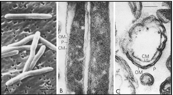 Gambar 1. (A) Fusobacterium nucleatum dilihat melalui mikroskop elektron, (B dan C) melalui mikroskop elektron terlihat Outer membran (OM), Periplasmik (P) dan Cell membrane (CM)17 