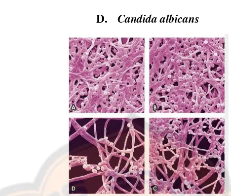 Gambar 4. Mikrograf fluoresensi Candida albicans dewasa. A) sebelum diinkubasi dengan 