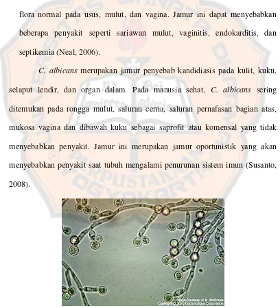 Gambar 5. Jamur Candida albicans (Bioweb, 2008) 