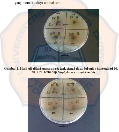 Gambar 2. Hasil uji difusi sumuran ekstrak etanol daun kemangi konsentrasi 10, 15, 20, 25% terhadap Staphylococcus epidermidis 