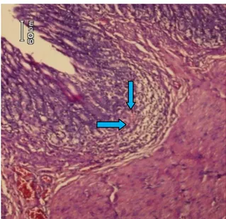 Gambar 4.  Gambaran mikroskopik lambung  tikus wistar  kelompok D, pembesaran 10x10  (panah biru: Sel-sel radang)