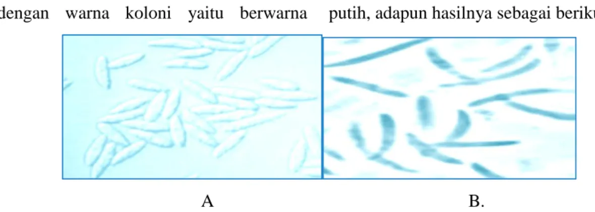 Gambar 1. Konidia Colletotrichum: (A). Colletotrichum acutatum, (B). Colletotrichum capsici  Keterangan : 