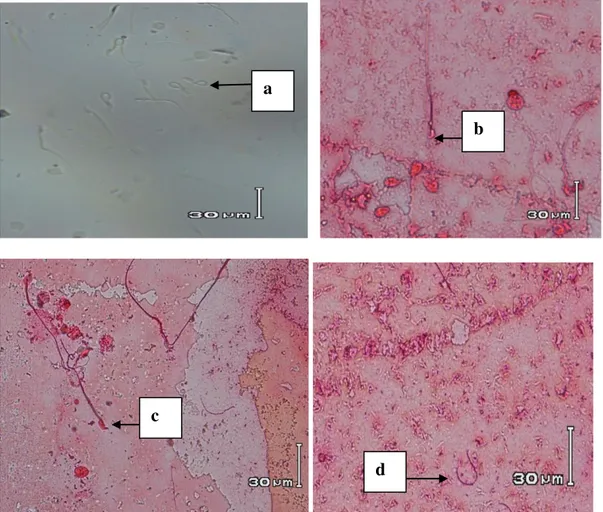 Gambar  2.  Kualitas  spermatozoa,  a)  keutuhan  membran  plasma;  b)  spermatozoa    yang  hidup;  c)  spermatozoa yang mati; d) spermatozoa yang abnormal