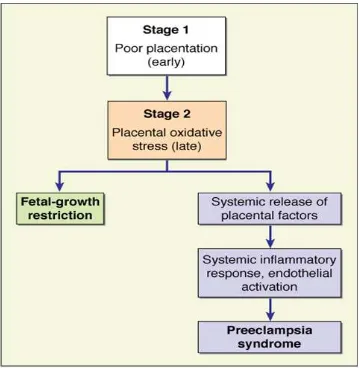 Gambar 1. Skema teori sindrom preeklampsia terdiri dari 2 tahap.14