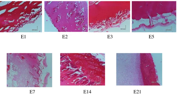 Gambar 5 : Uji histopatologi dan diagnosa kelompok kelinci 5 pada hari 1, 2, 3, 5, 7, 14 dan 21                  E1                             E2                                E3                             E5 
