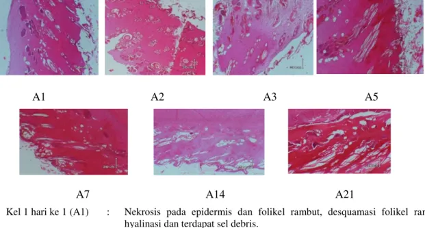 Gambar 1. Hasil uji histopatologi dan diagnosa kelompok kelinci 1 pada hari 1, 2, 3, 5,  7, 14 dan 21 