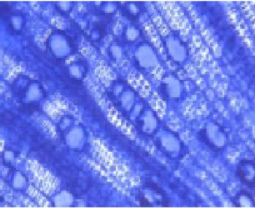 Gambar 1. Hifa O.theobromae menginfeksi xylem, diwarnai dengan lactophenol cotton blue