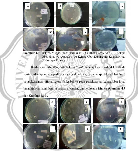 Gambar 4.9 Bakteri S. typhi pada perlakuan  (A) Obat diare Lodia (B) Kelapa 