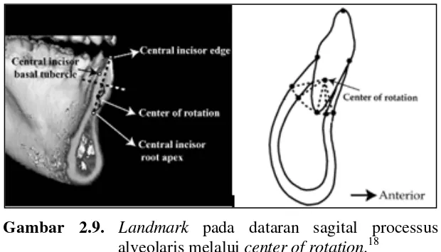 Gambar 2.9. Landmark pada dataran sagital processus 