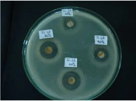 Gambar 12. Hasil Uji Antibakteri Ekstrak Umbi Lokio dengan Pelarut Etilasetat terhadap Bakteri Lactobacillus acidophilus 