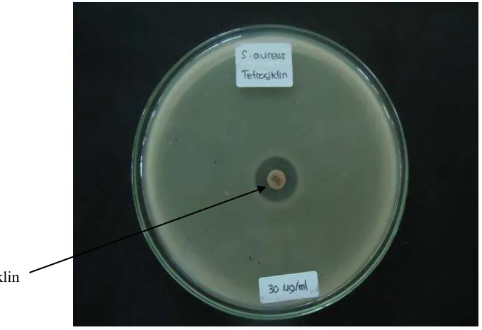 Gambar 13. Hasil Uji Antibakteri Baku Pembanding Tetrasiklin terhadap Bakteri Escherichia coli 