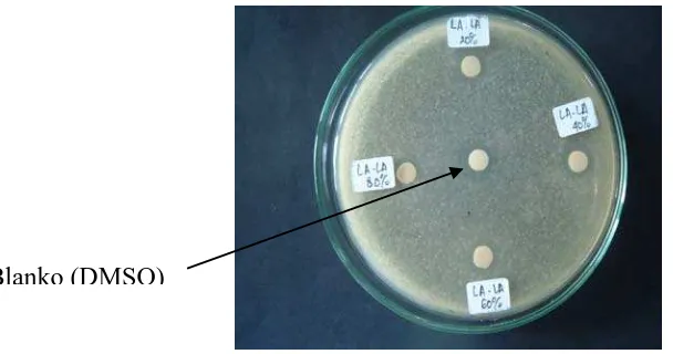 Gambar 3. Hasil Uji Antibakteri Ekstrak Umbi Lokio dengan Pelarut Air terhadap Bakteri Shigella dysenteriae 