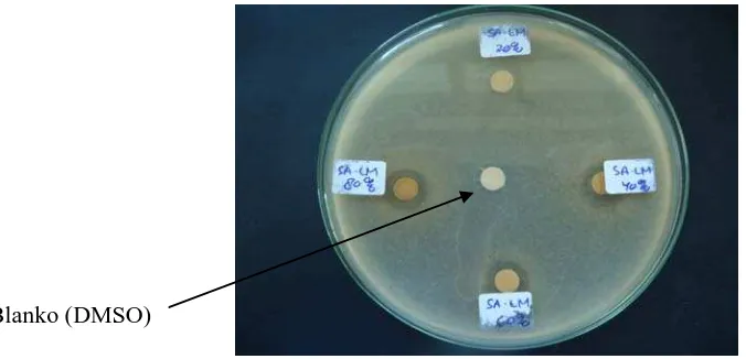 Gambar 5. Hasil Uji Antibakteri Ekstrak Umbi Lokio dengan Pelarut Metanol terhadap Bakteri Escherichia coli 