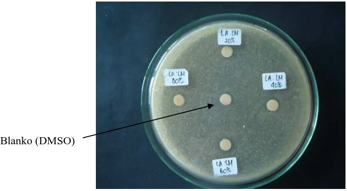 Gambar 7. Hasil Uji Antibakteri Ekstrak Umbi Lokio dengan Pelarut Metanol terhadap Bakteri Shigella dysenteriae 
