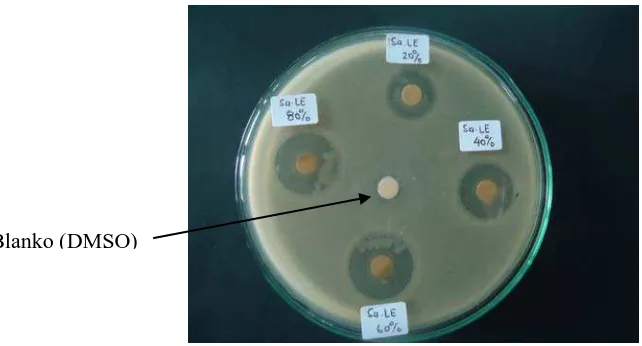Gambar 9. Hasil Uji Antibakteri Ekstrak Umbi Lokio dengan Pelarut Etilasetat terhadap Bakteri Escherichia coli 