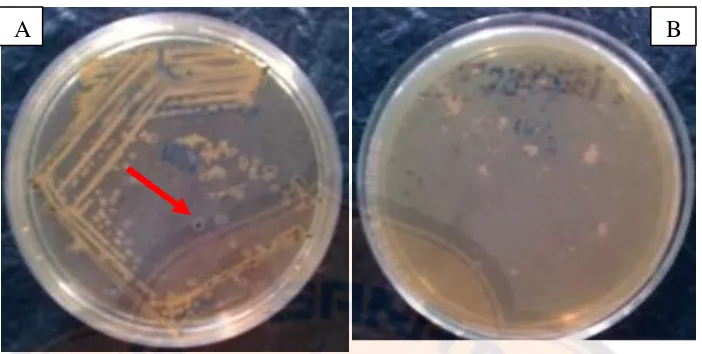 Gambar 6. Hasil uji isolasi bakteri dari jamu cekok : kontrol positif S.aureus ATCC 