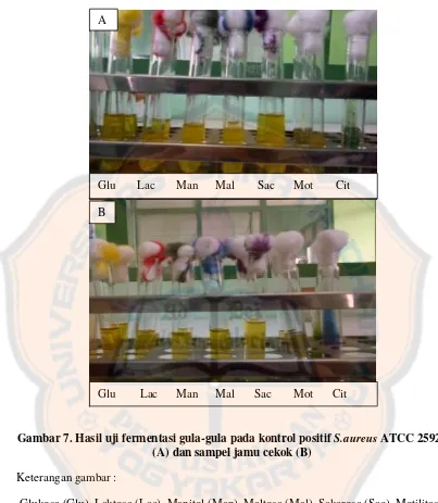 Gambar 7. Hasil uji fermentasi gula-gula pada kontrol positif S.aureus ATCC 25923 