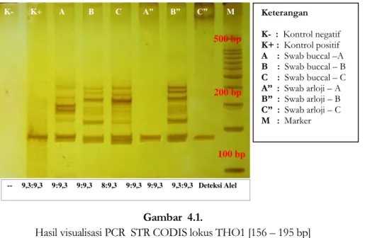 Gambar 4.1., di atas menunjukkan visualisasi hasil PCR dengan Polyacrylamid  Agarose Composite Gel Elektroforesis [PAGE] dengan pengecatan Silver Staining pada  Short Tandem Repeat - Combined DNA Index System [STR- CODIS] lokus THO1  [amplicont product 156