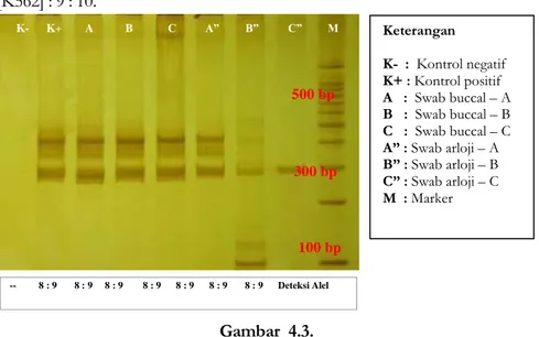 Gambar  4.2.,  di  atas  menunjukkan  visualisasi  hasil  PCR  dengan  PAGE  dengan  pengecatan  Silver  Staining  pada  STR  CODIS  lokus  CSF1PO  [amplicont  product 321–357 bp] pada semua sampel  terdeteksi [deteksi +] pada kontrol positif  [K562] : 9 :