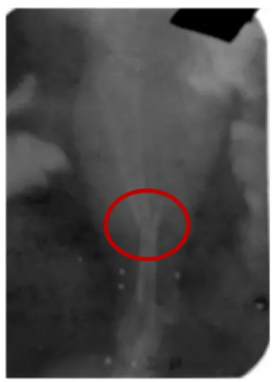 Gambar 1 .   Foto rontgen tulang tibia sinistra  tikus     wistar jantan setelah induksi fraktur tulang