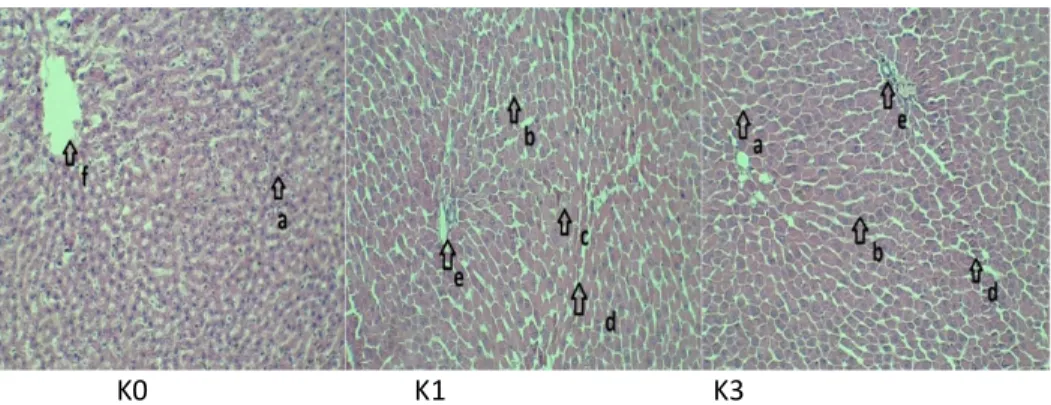 Gambar  1.  Gambaran  histopatologi  hepar  tikus  putih,  pengecatan  hematoksilin  eosin,  pembesaran  100x