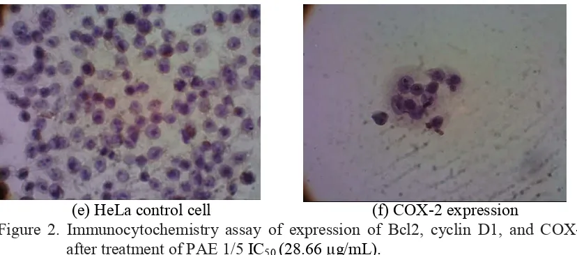 Figure 2. Immunocytochemistry assay of expression of Bcl2, cyclin D1, and COX$2 