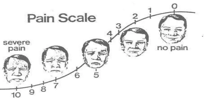 Gambar 2.2-3. Visual Analogue Scale 