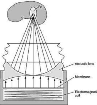 Gambar 2.5. Gambaran skematik generator gelombang elektromagnetik yang   menggunakan lensa akustik untuk memfokuskan gelombang Sumber: Ferrandino, M.N., Pietrow, P.K., dan Preminger, G.M., Evaluation and   Medical Management of Urinary Lithiasis
