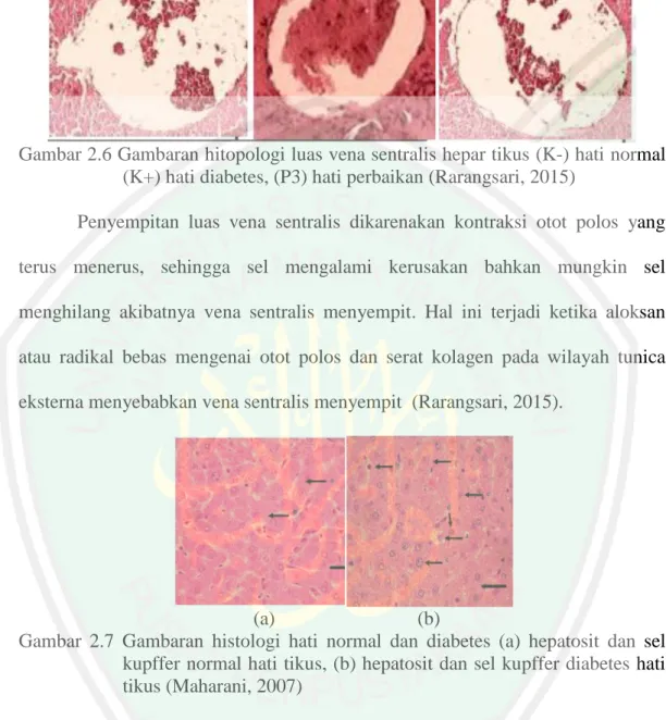 Gambar  2.7  Gambaran  histologi  hati  normal  dan  diabetes  (a)  hepatosit  dan  sel  kupffer normal hati tikus, (b) hepatosit dan sel kupffer diabetes hati  tikus (Maharani, 2007) 