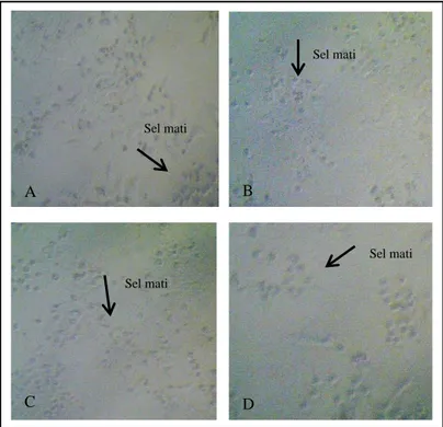 Gambar 3. Morfologi sel T47D diamati menggunakan mikroskop dengan perbesaran 100x setelah  perlakuan sampel kombinasi
