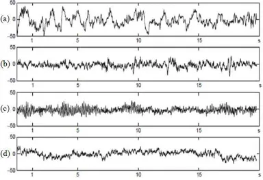Gambar 2.3 Karakteristik Ritme EEG Pada Manusia Normal (dalam μV). (a) Ritme Delta, (b) Theta, (c) Alpha, dan (d) Beta (Donald, 2015)